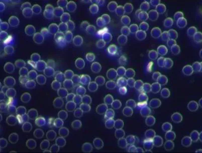 Гъста кръв със слепени еритроцити